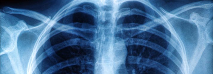 Chronic Pain New Providence NJ X-Rays Available Chronic Pain New Providence NJ X-Rays Available